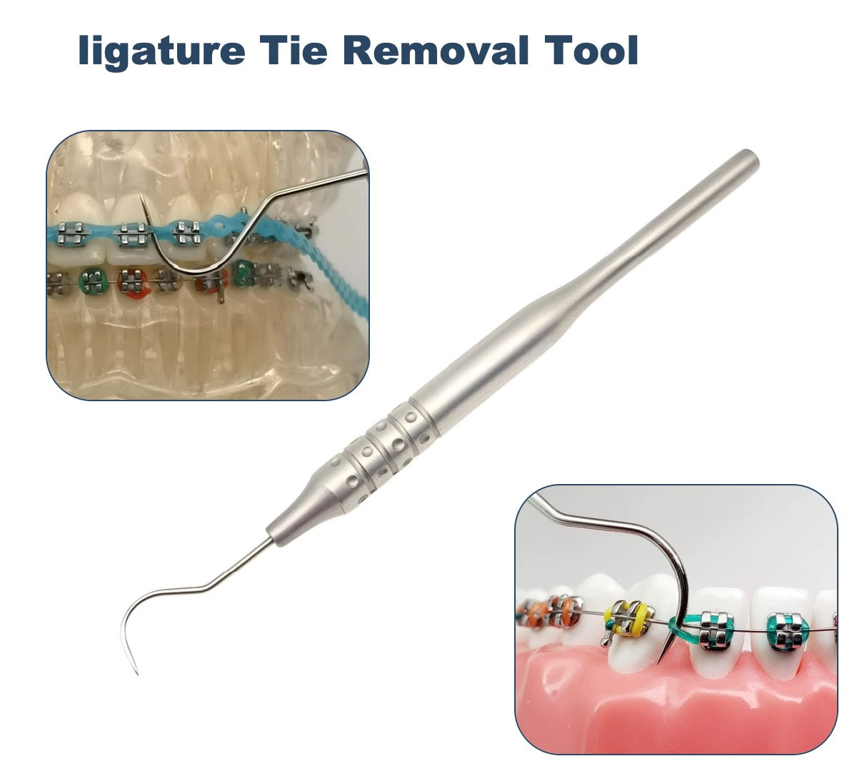 Braces DIY Tool Kit