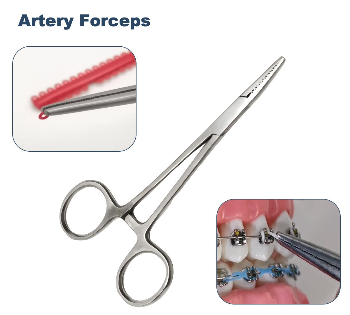 Braces DIY Tool Kit