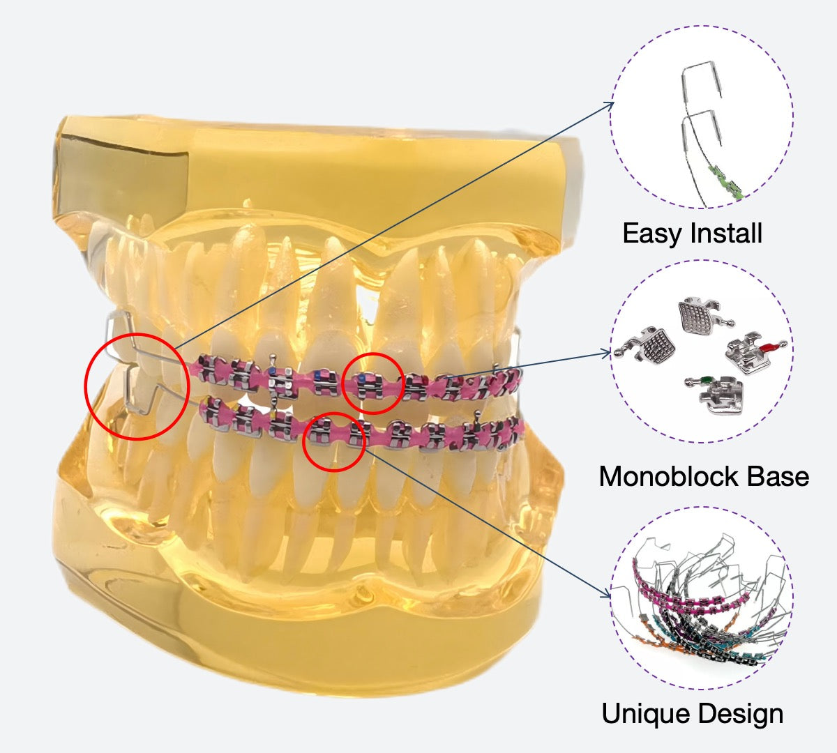 One Step Fake Braces Kit Clip With Power Chain