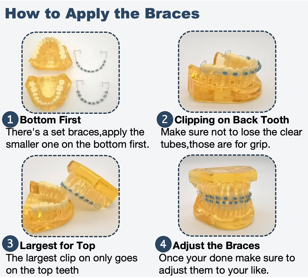 One Step Fake Braces Kit Clip With Power Chain
