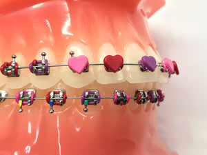 Fun Braces Ligature Ties