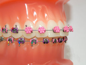 Fun Braces Ligature Ties