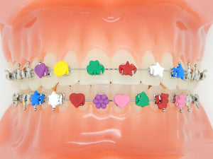 Fun Braces Ligature Ties