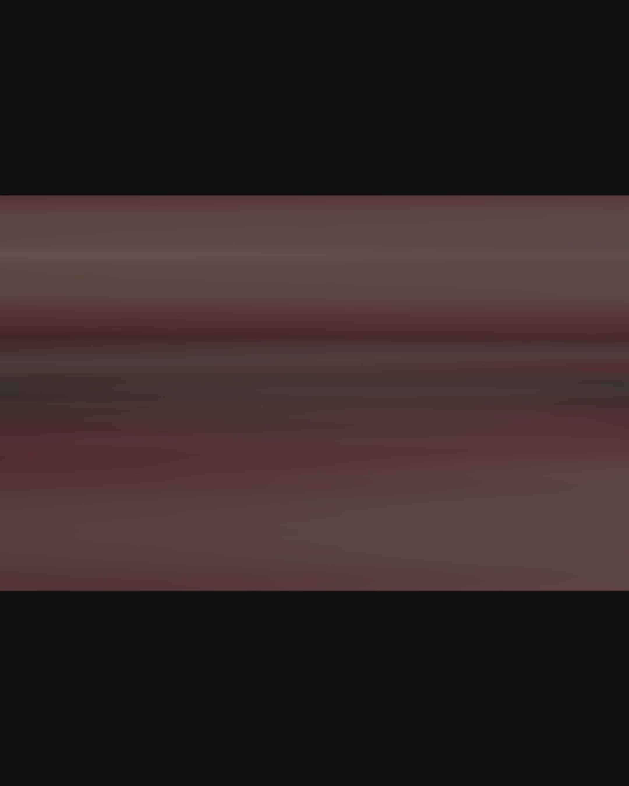 Standard Orthodontic Ligatures